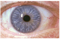 oog1